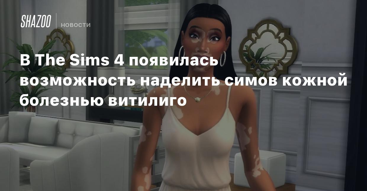 В The Sims 4 появилась возможность наделить симов кожной болезнью витилиго  - Shazoo