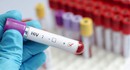 Новая вакцина от ВИЧ готова к масштабному тестированию