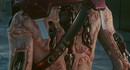 Фанат Cyberpunk 2077 обнаружил крайне редкого и жуткого NPC с ужасающими имплантами