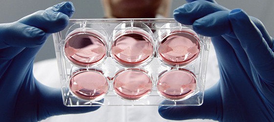 Sunday Science: первые испытания перепрограммированных стволовых клеток начнутся в 2013-м