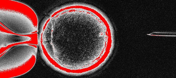 Sunday Science: успешно клонированы стволовые клетки человека