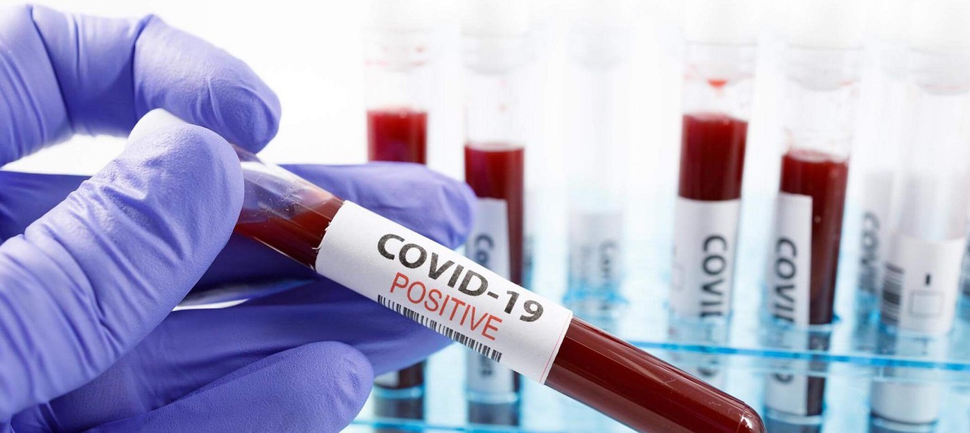 Антитела к коронавирусу COVID-19 остаются активными около четырех месяцев