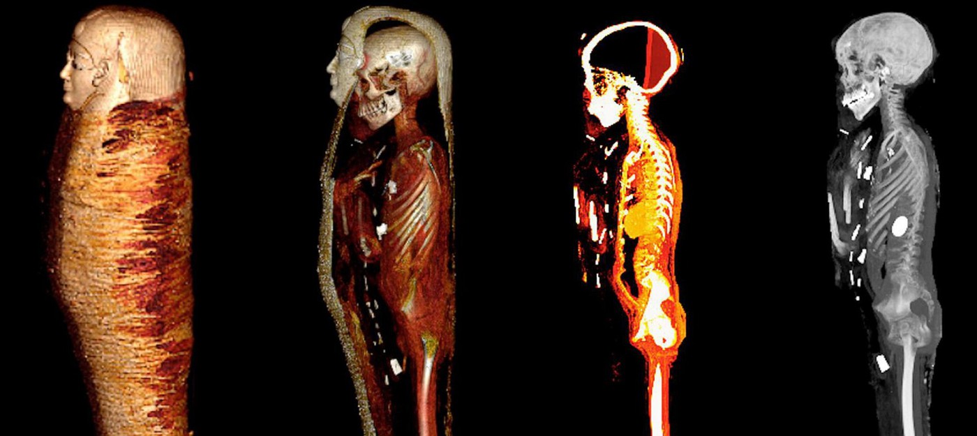 Ученые обнаружили 49 амулетов в теле мумии "золотого мальчика"