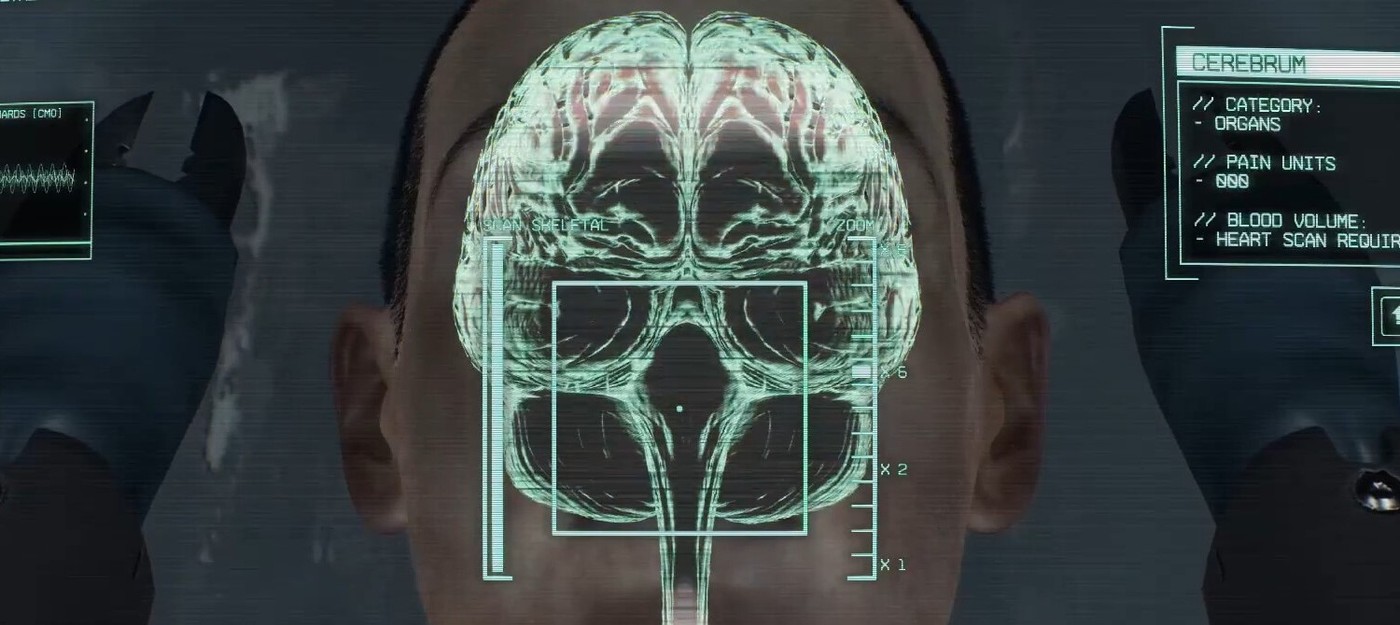 Спасаем членов экипажа от траснформации в монстров трейлере симулятора космического ИИ-хирурга Malpraxis