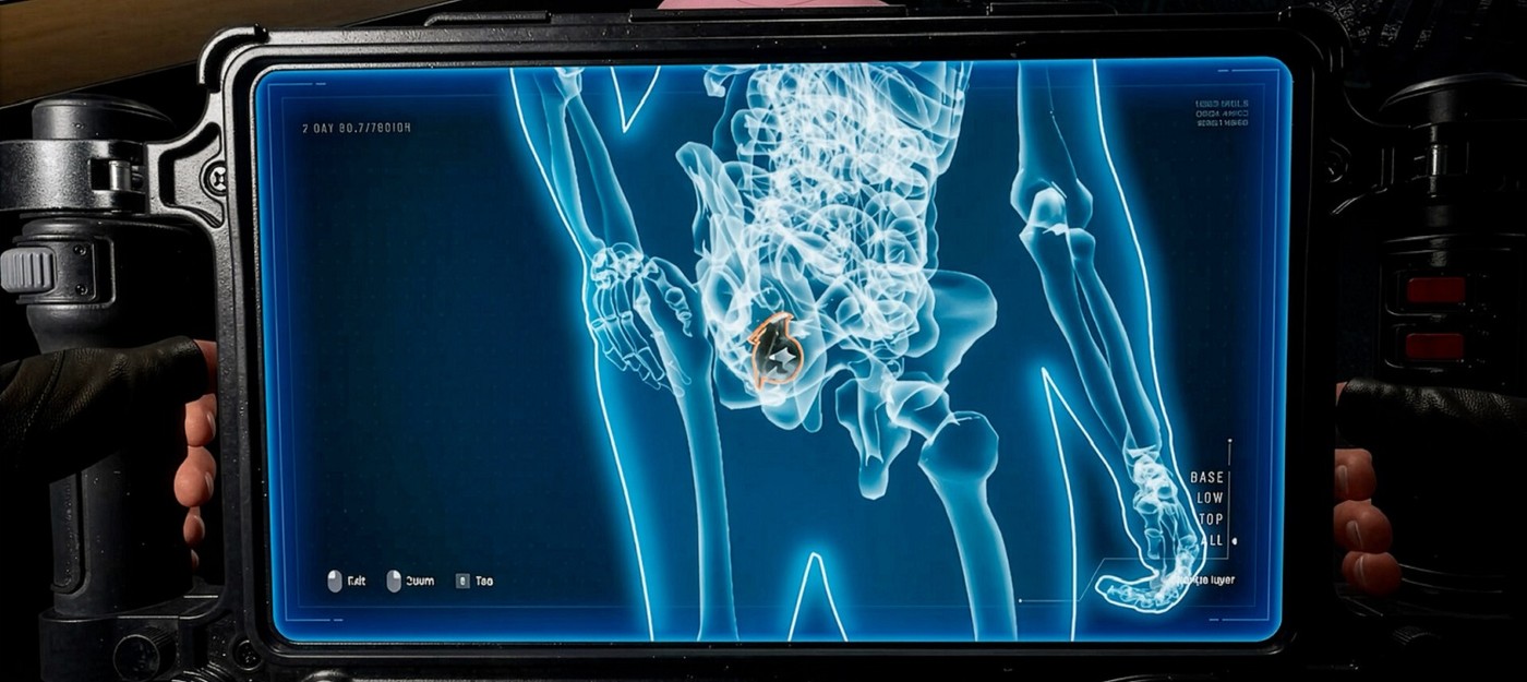 Разработчики Quarantine Zone: The Last Check починили рентген, так что теперь вы сможете увидеть спрятанные в задницах гранаты и наркотики