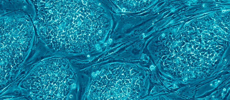 Прорыв в области стволовых клеток может вылечить диабет первого типа