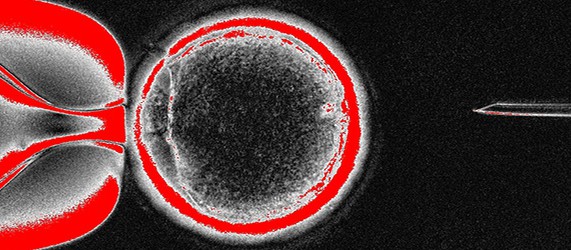 Sunday Science: успешно клонированы стволовые клетки человека