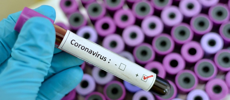 Коронавирус: в США начали тестировать первую вакцину на людях