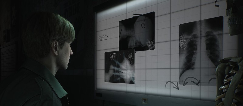 В ремейке Silent Hill 2 пообещали первоклассный визуальный стиль