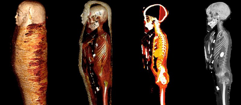 Ученые обнаружили 49 амулетов в теле мумии "золотого мальчика"