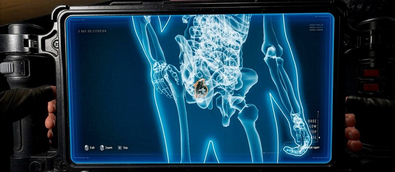 Разработчики Quarantine Zone: The Last Check починили рентген, так что теперь вы сможете увидеть спрятанные в задницах гранаты и наркотики