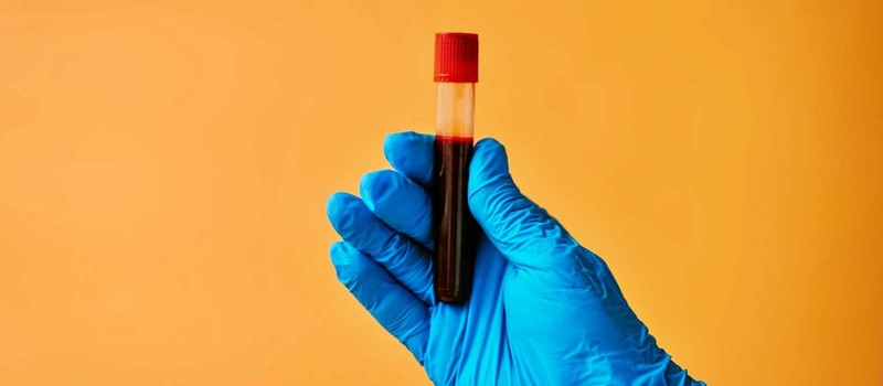 Учёные научились предсказывать начало болезни Альцгеймера по анализу крови