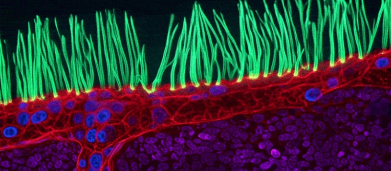 Победное видео 16-го конкурса Nikon Small World in Motion заподозрили в использовании ИИ