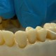 Первый в мире препарат для регенерации зубов будет протестирован на людях в сентябре