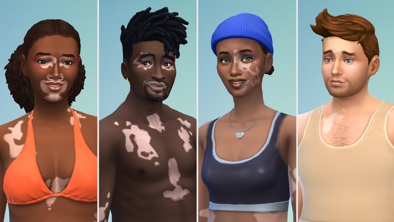 В The Sims 4 появилась возможность наделить симов кожной болезнью витилиго